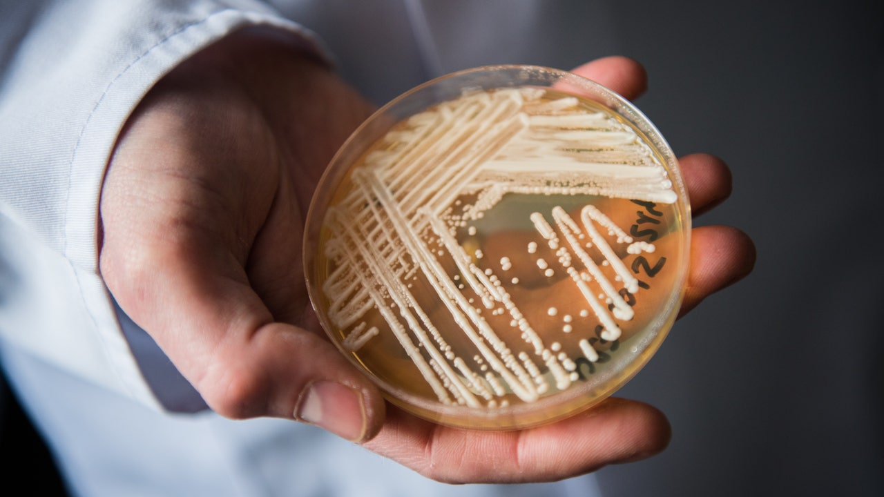 Untreatable, deadly superbug fungus outbreak reported at two North